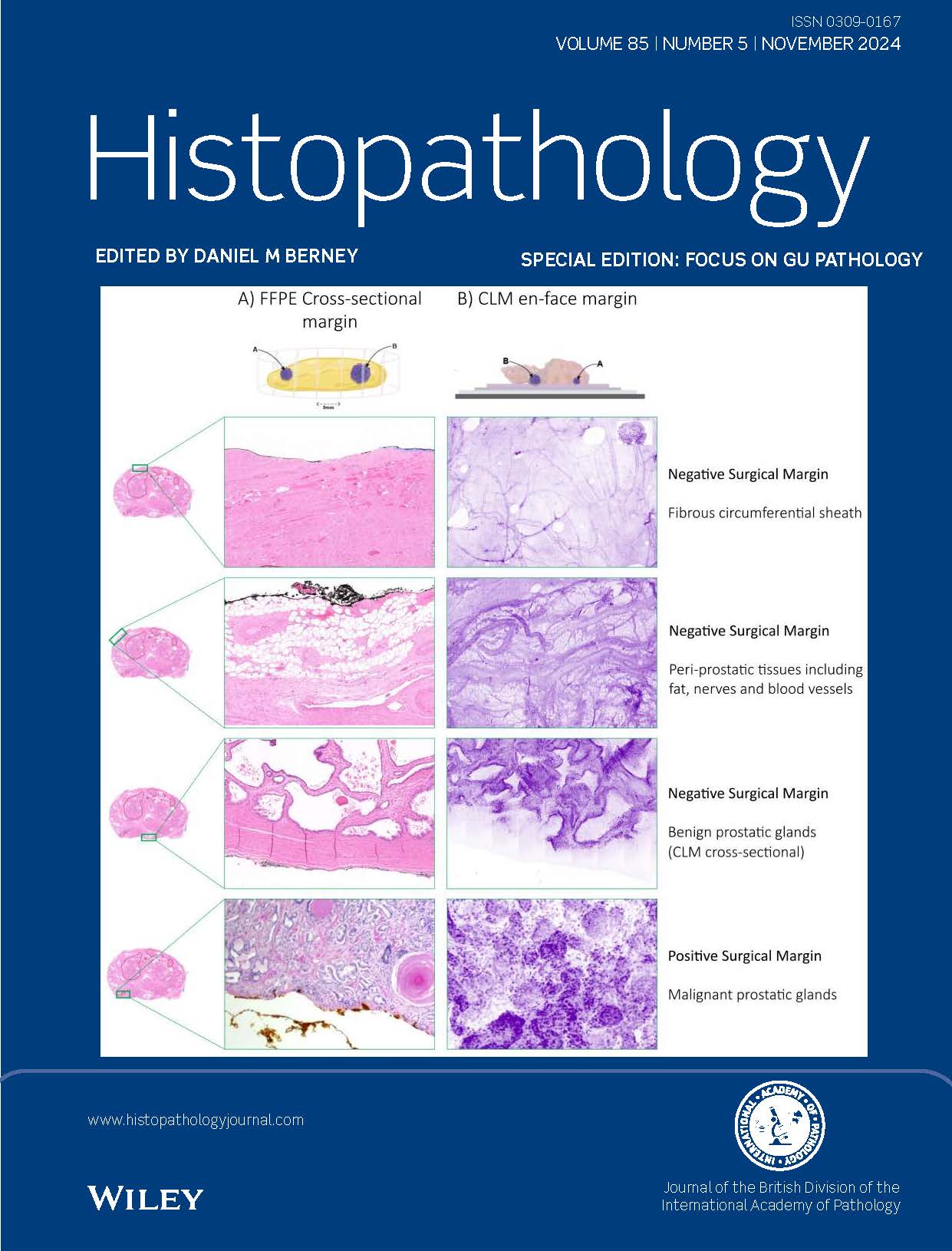 Histopathology Latest Journal Issue: Now Available image